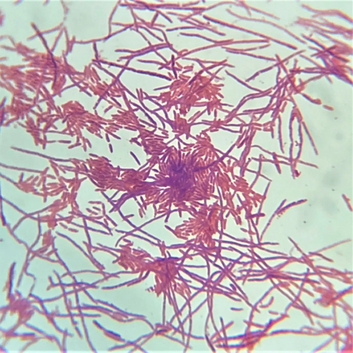 Gram-stained Pseudomonas bacteria under the microscope