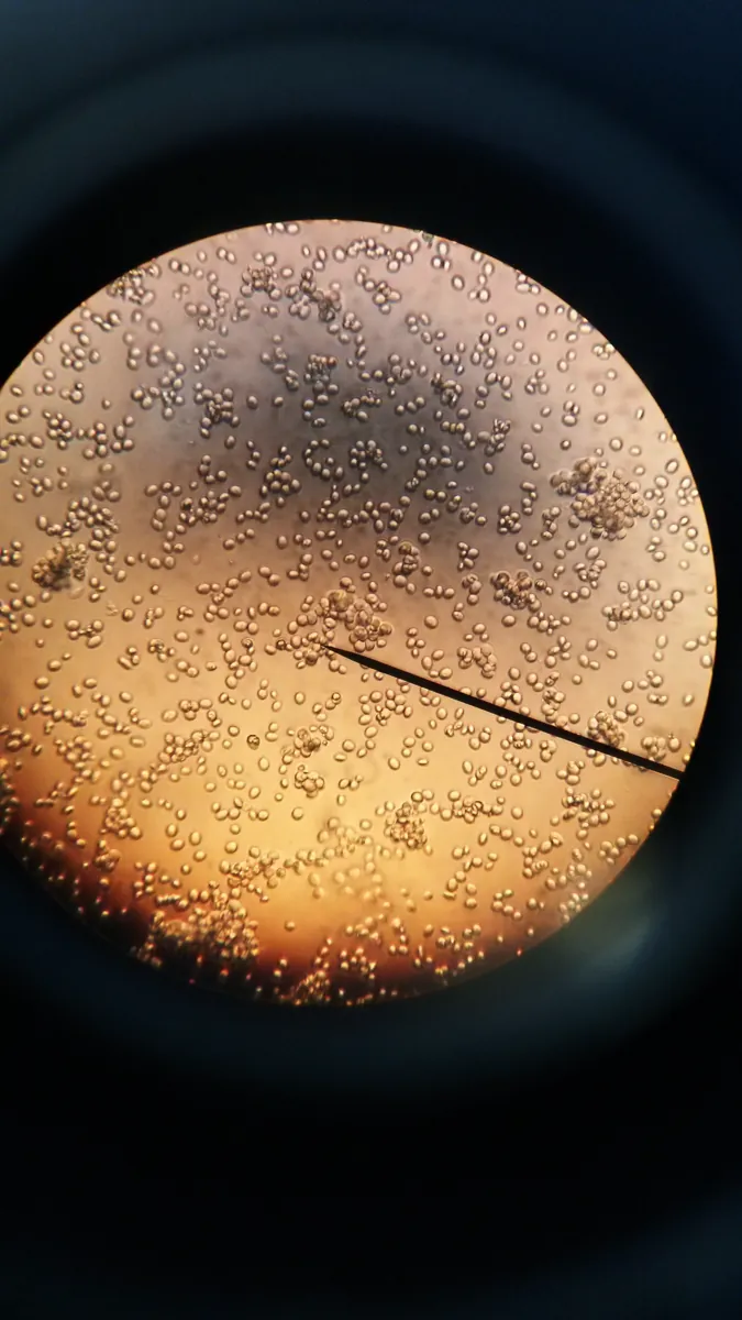Yeast cells seen through a microscope eyepiece